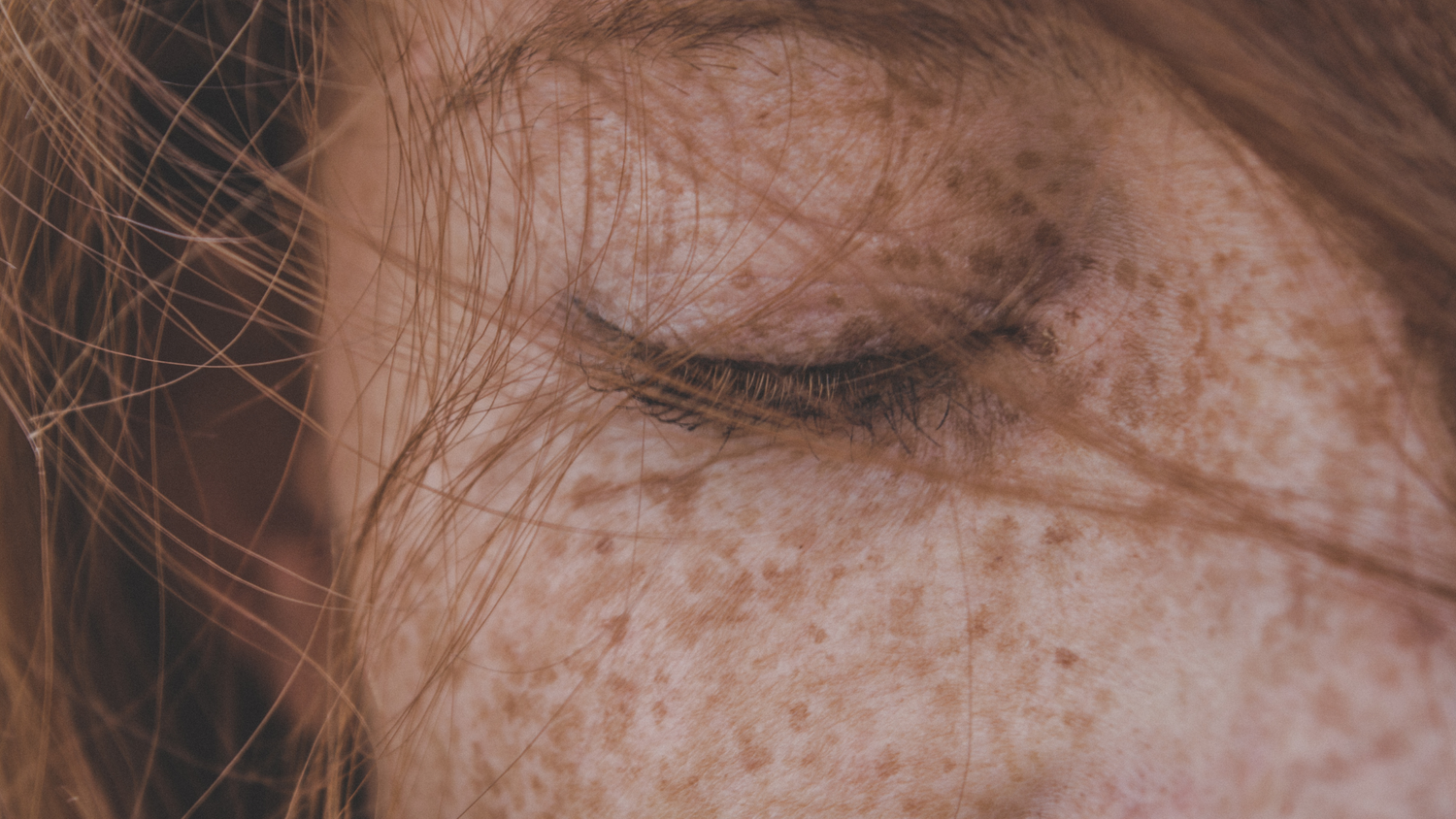 How to Address Hyperpigmentation with Natural Skincare: A Science-Backed Guide