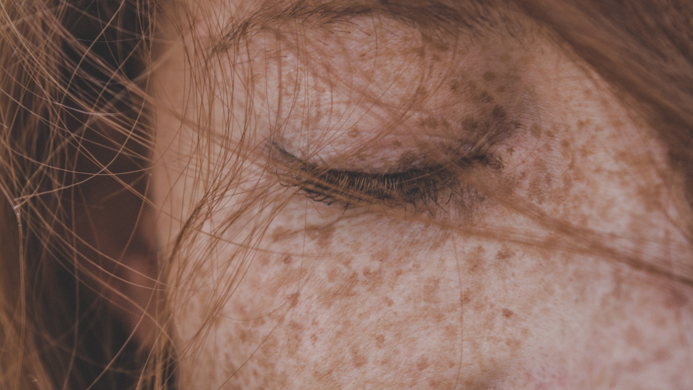 How to Address Hyperpigmentation with Natural Skincare: A Science-Backed Guide